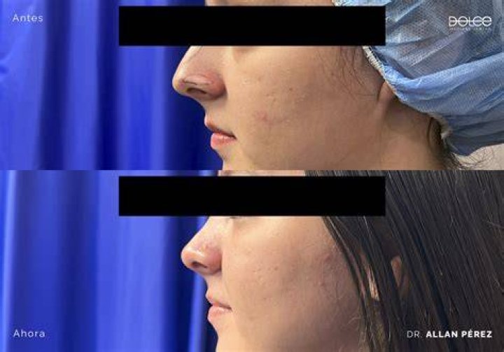 Antes y después así lucía Karely Ruiz antes de las cirugías La Sabrosita