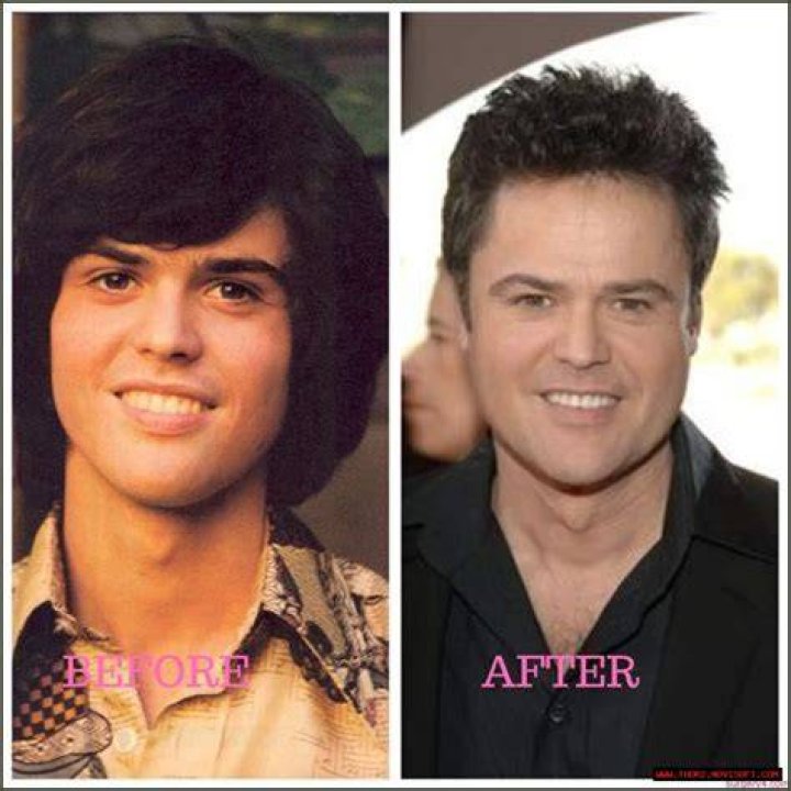 Insider Secrets Of His Plastic Surgery Journey