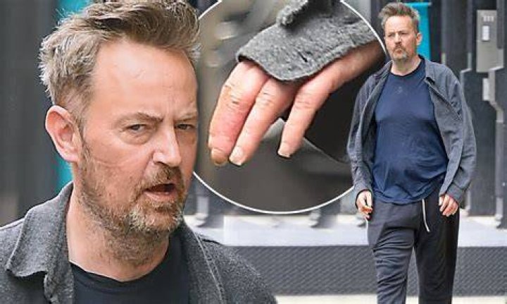Matthew Perry's Finger Injury Exposed