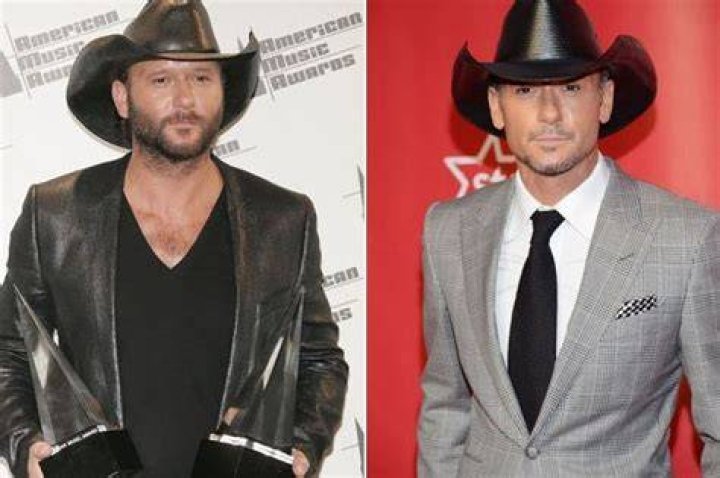 Tim Mcgraw plastic surgery 37 Celebrity plastic surgery online