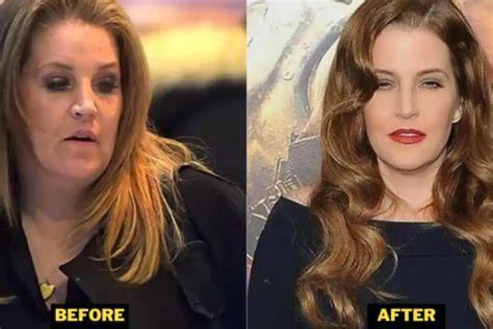 Unveiling The Truths Behind Lisa Marie Presley's Weight Gain Journey: Insights9 Exclusive