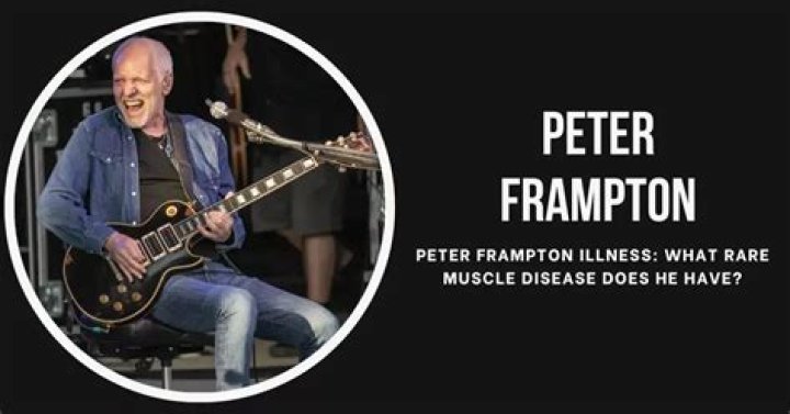 What Illness Does Peter Frampton Have? Health Problems Explained